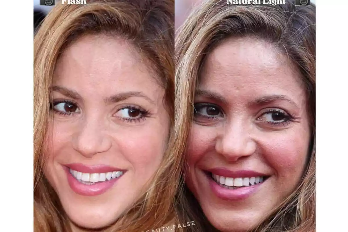 Foto comparativa de Shakira sonriendo con flash y sin flash Foto comparativa de Shakira sonriendo con flash y sin flash